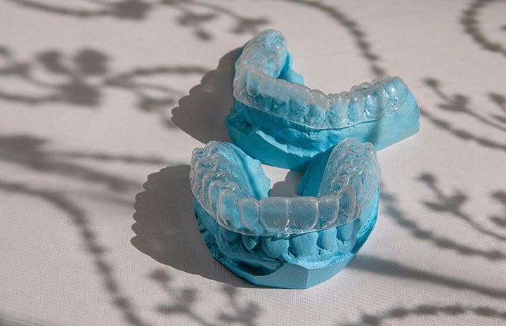 Invisalign® | Restor Dental | General & Cosmetic Dentist | Distillery District | Toronto